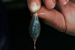 女子生吞蛇胆中毒，蛇胆的功效和作用[多图]