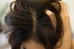 头发洗了一两天就出油怎么办？头发如何控油效果好？[多图]