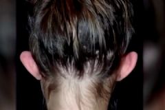 精灵耳女孩做整形，整形有哪些风险？[多图]