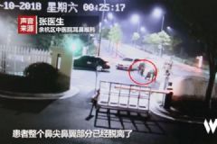 男子围观情侣吵架，被咬掉鼻尖，情侣间如何避免吵架？[多图]