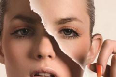 光子祛斑要多次才见效？光子祛斑有哪些风险？[多图]