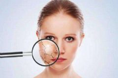 皮肤干竟是这些坏习惯害的！为什么皮肤会这么干？[多图]