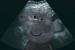 张歆艺怀孕，恰巧是袁弘的生日，双喜临门？[多图]