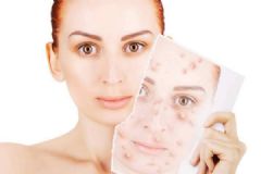 如何让皮肤保持水润有光泽？怎样让皮肤水嫩嫩？[多图]