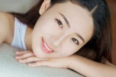 去黄褐斑的方法有哪些？激光能根除黄褐斑吗？[多图]