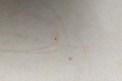 甘肃一幼儿园被曝针扎孩子，派出所疑让园方拿钱摆平[多图]