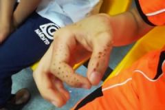 仙人掌从15楼掉落，男孩身上多处被砸成马蜂窝[多图]