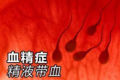 男人得了血精症怎么办？推荐四大血精症的食疗方！[图]